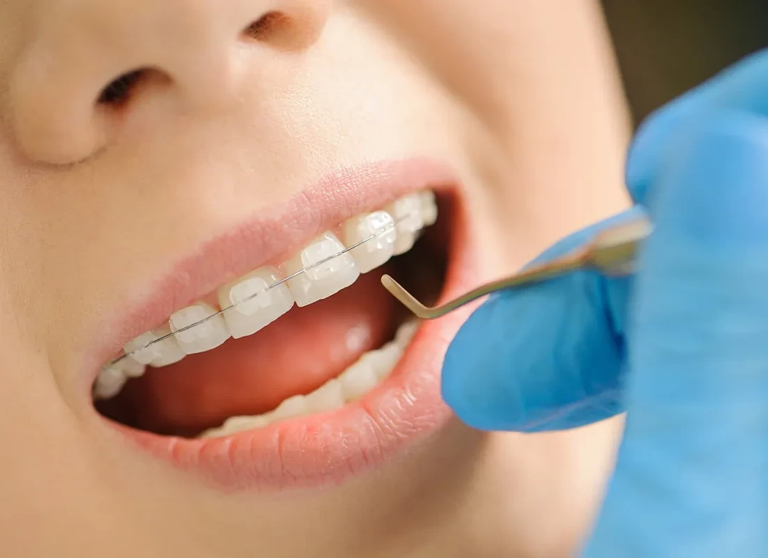 Dental-check-up.webp