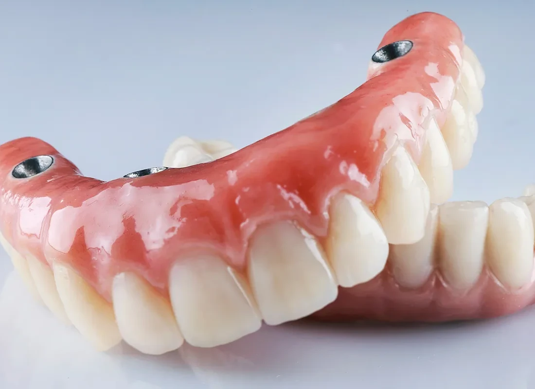 Dentures.webp