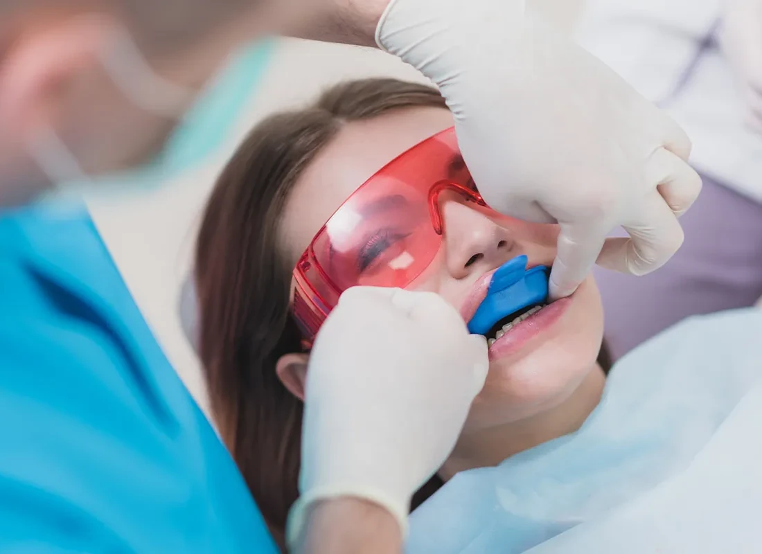 Fluoride-treatment.webp