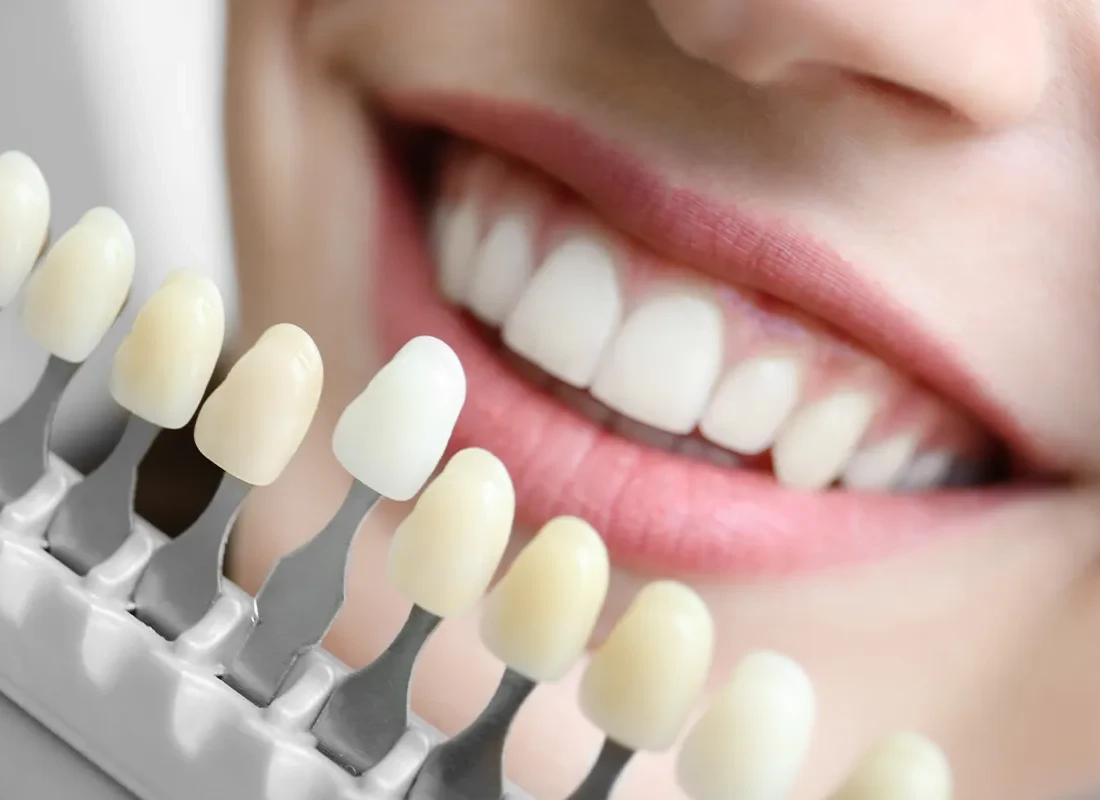 Teach-whitening-2.webp