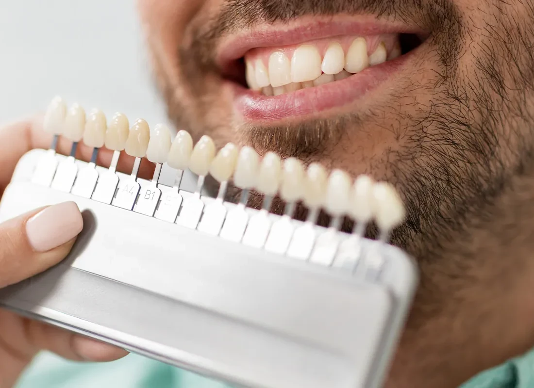 Teeth-whitening.webp