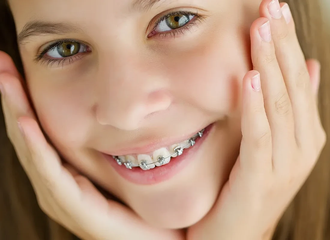 braces-8.webp