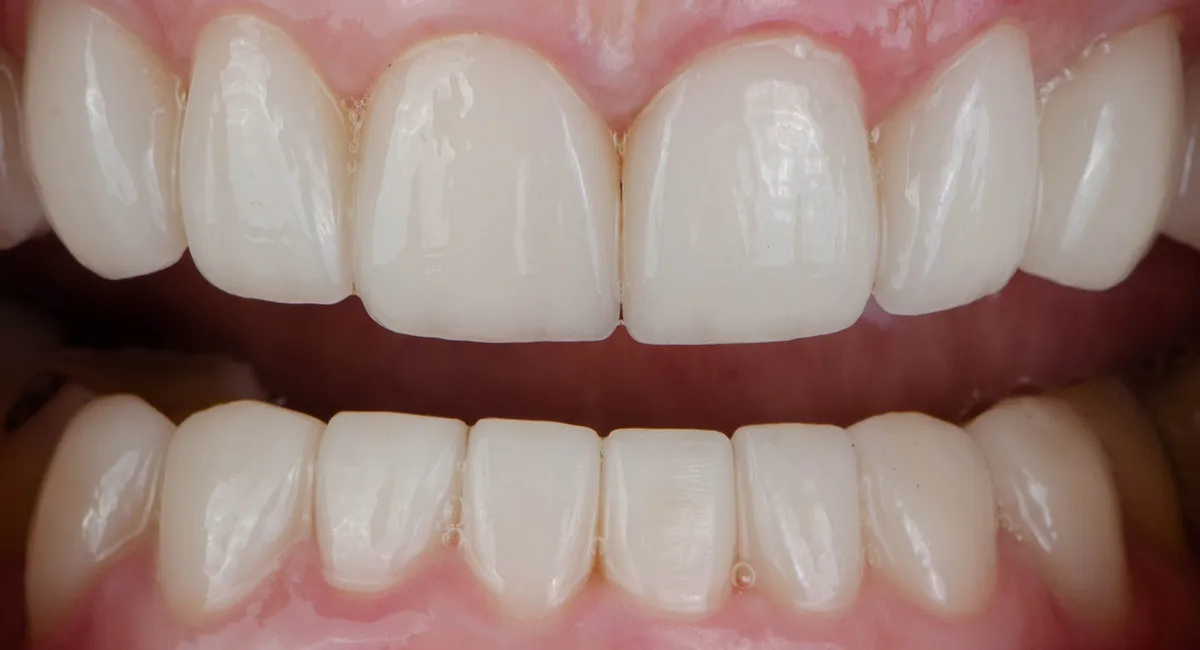 case-1-after.webp