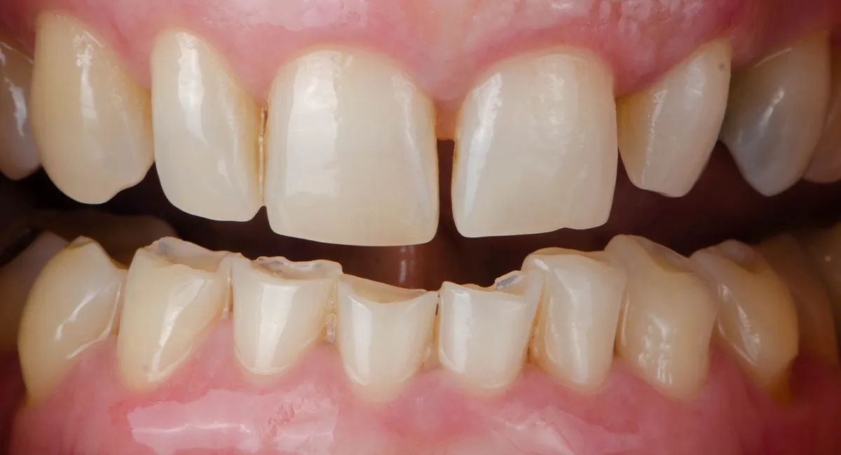case-1-before.webp