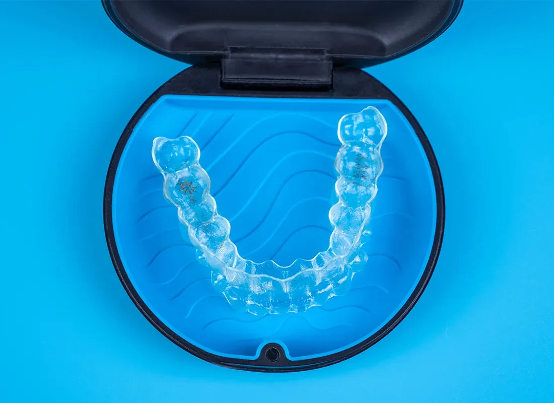 Terapia con Alineadores Transparentes en Exceptional Dentistry