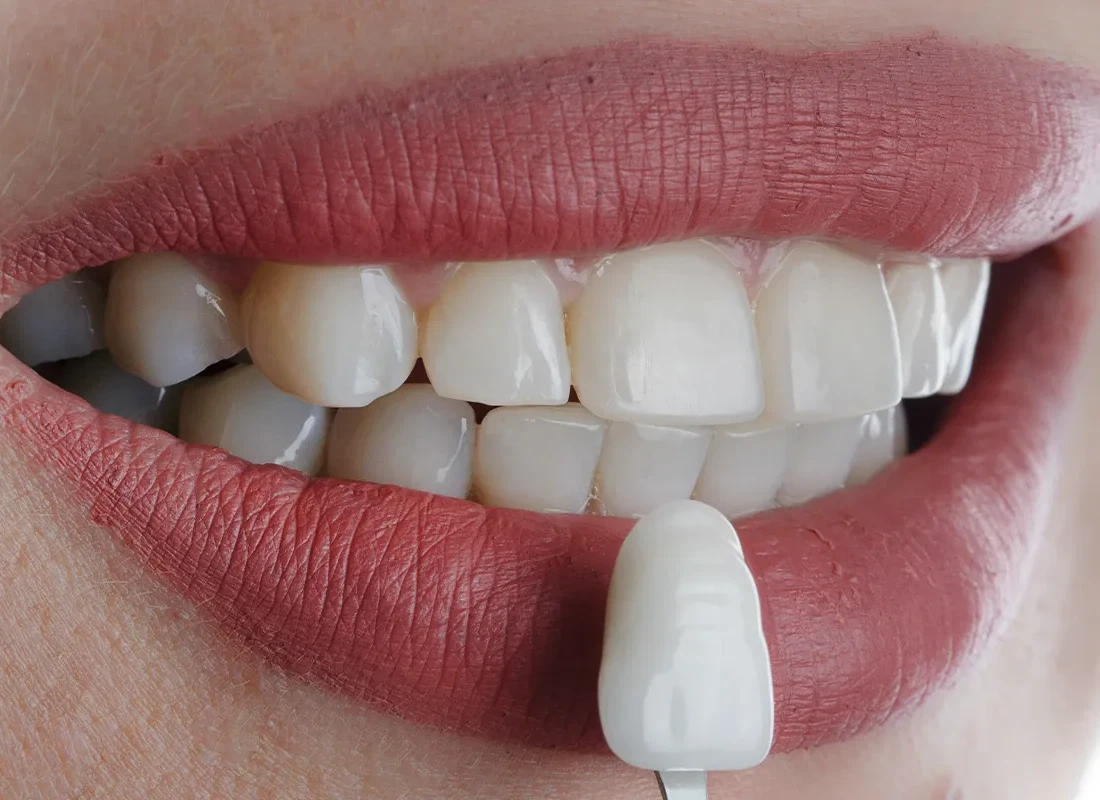 cosmetic-dentistry-1.webp
