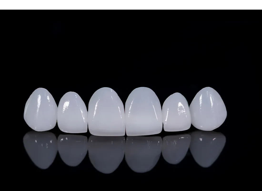 dental-bridge-4.webp