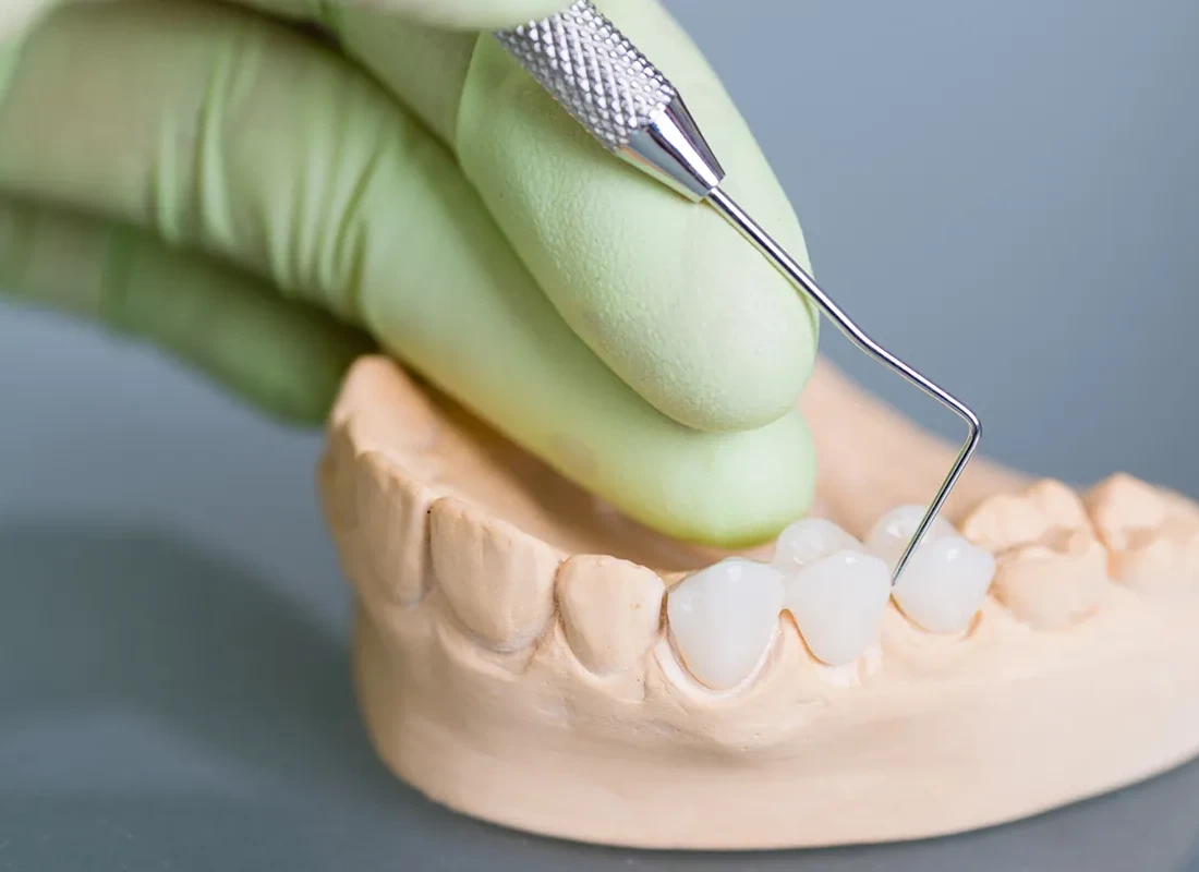 dental-bridge-lab-2.webp