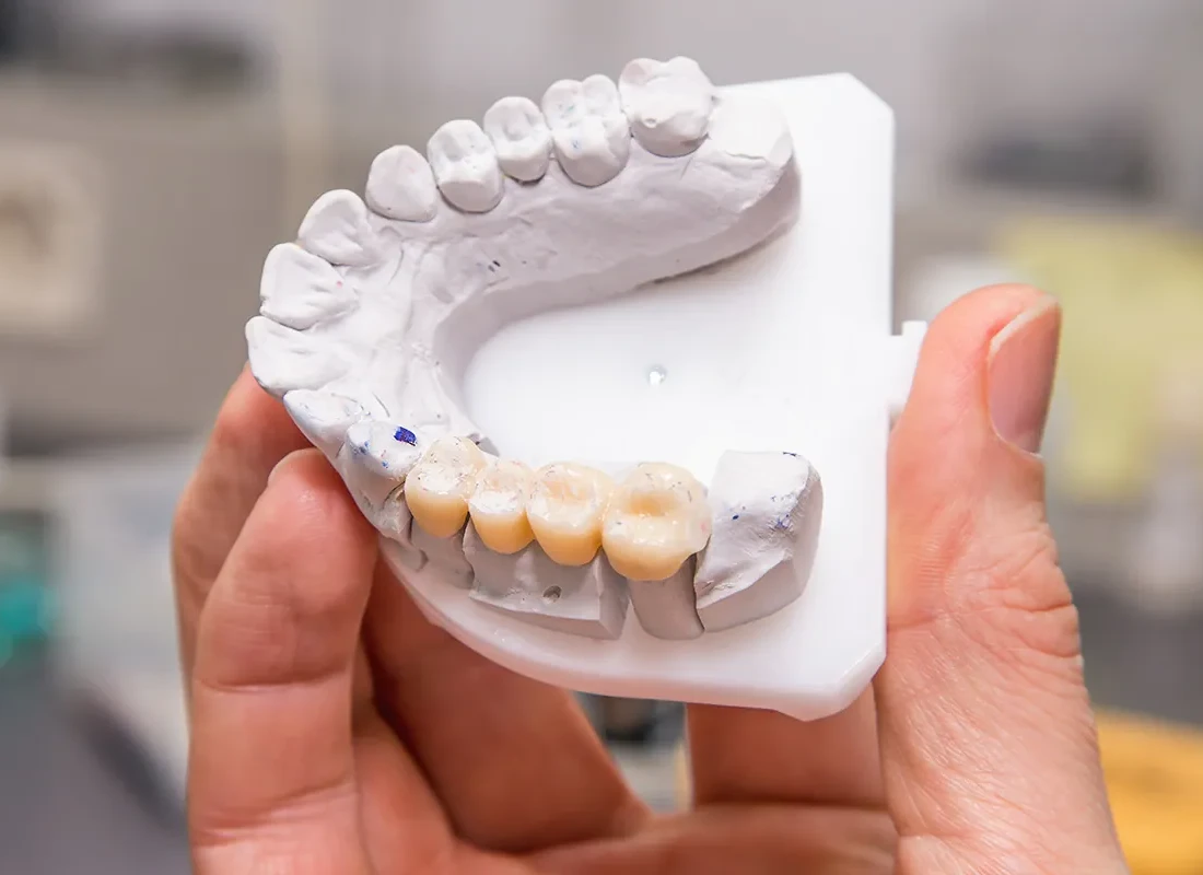 dental-bridge-lab.webp
