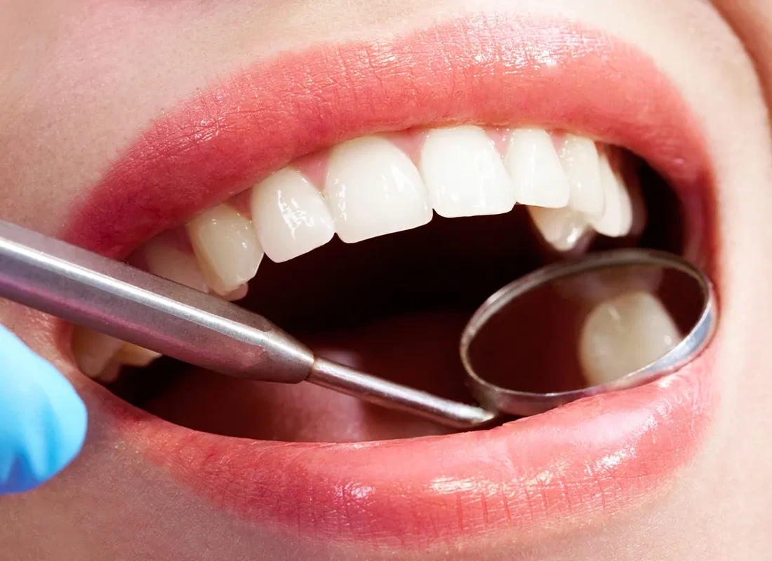 dental-checkup-5.webp