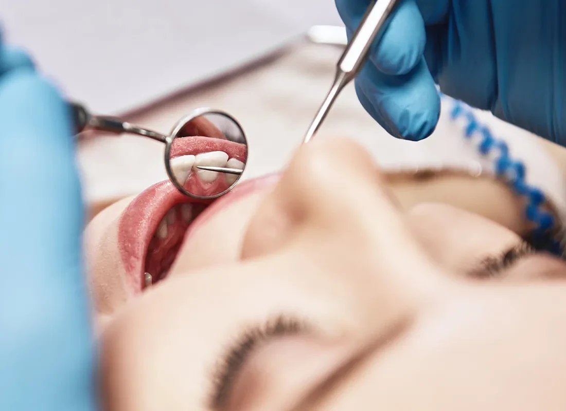dental-checkup-dentist.webp