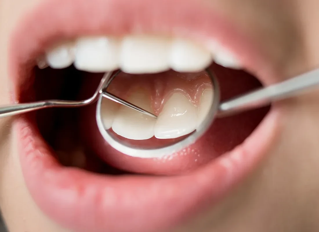 dental-checkup-patient.webp
