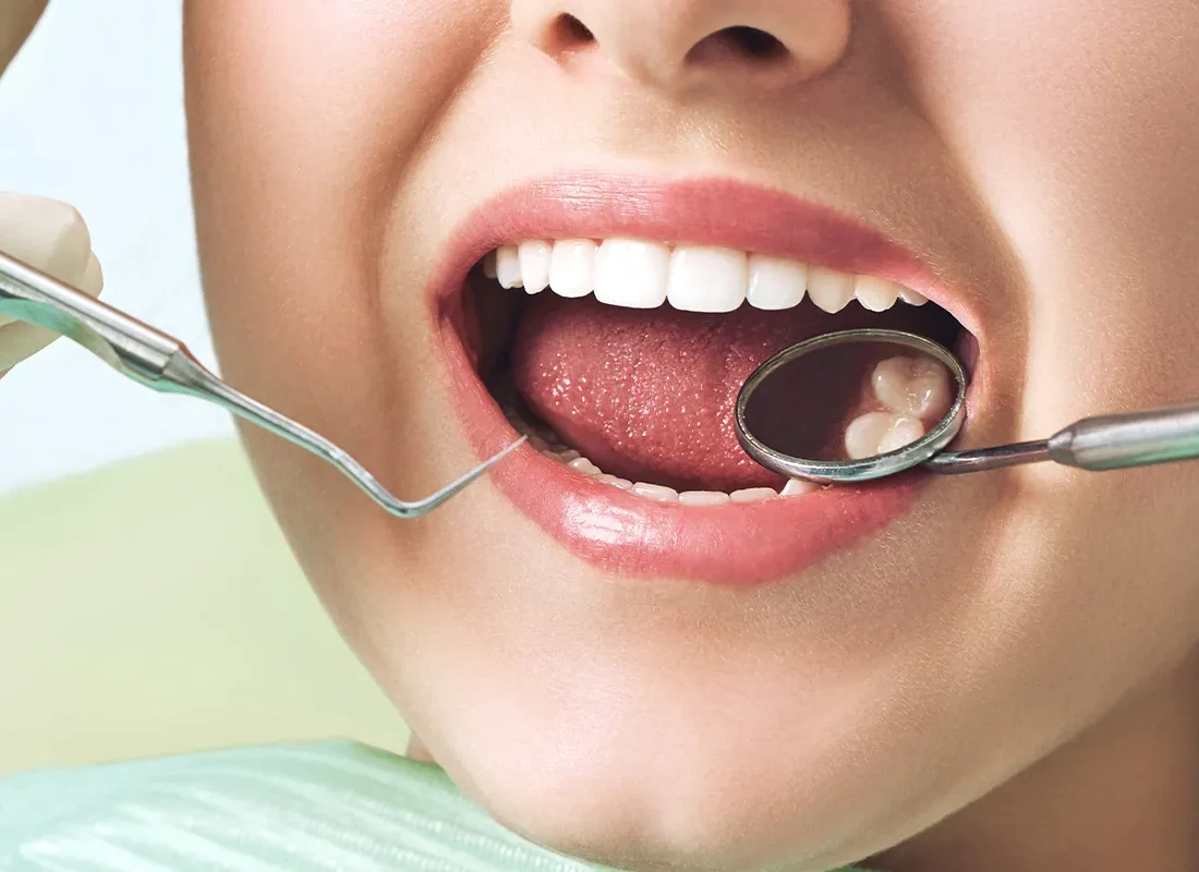 dental-checkup.webp