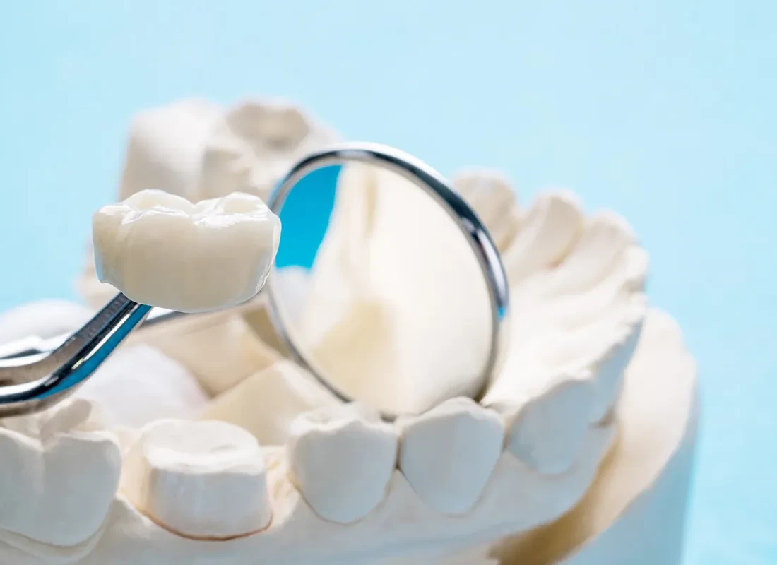 dental-crown-lab-4.webp