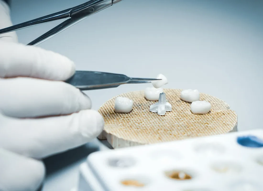 dental-crown-lab.webp