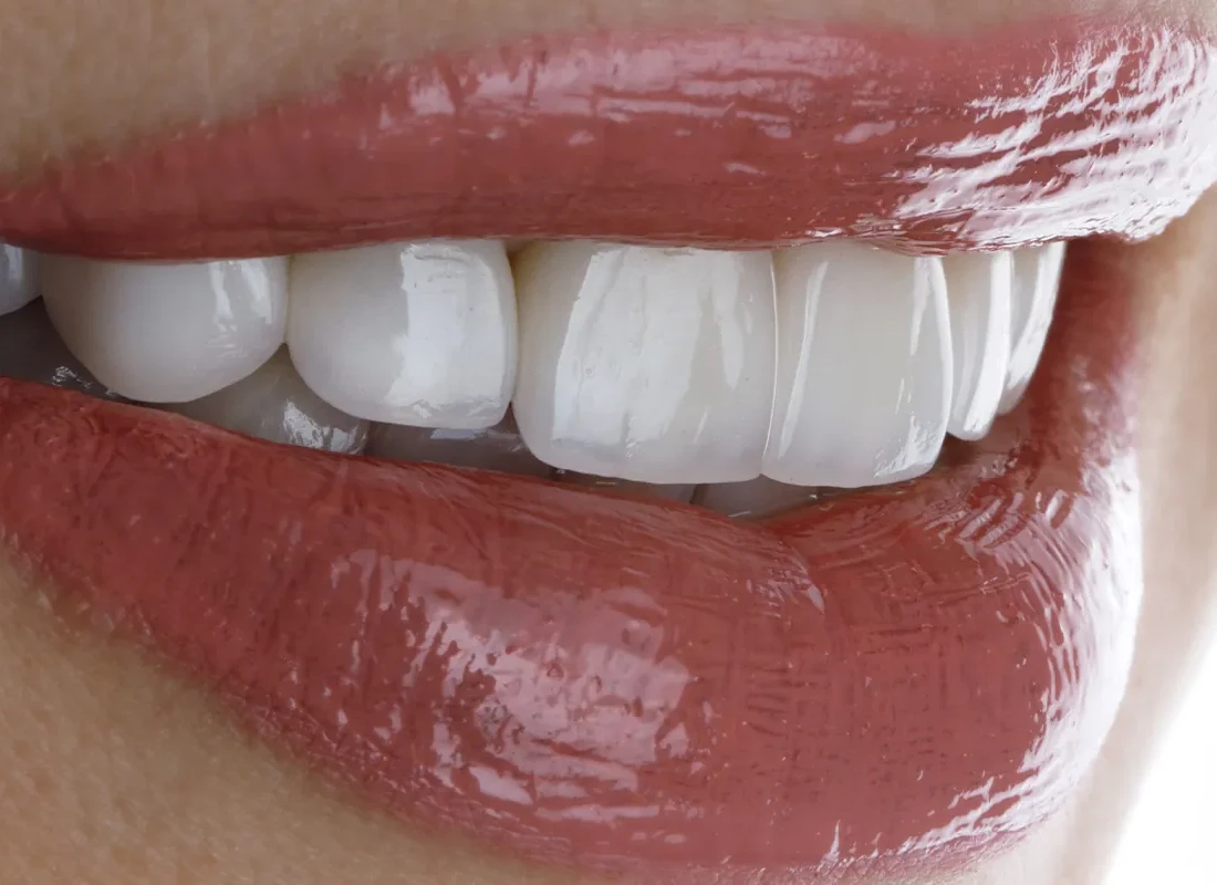 great-smile=-patient.webp