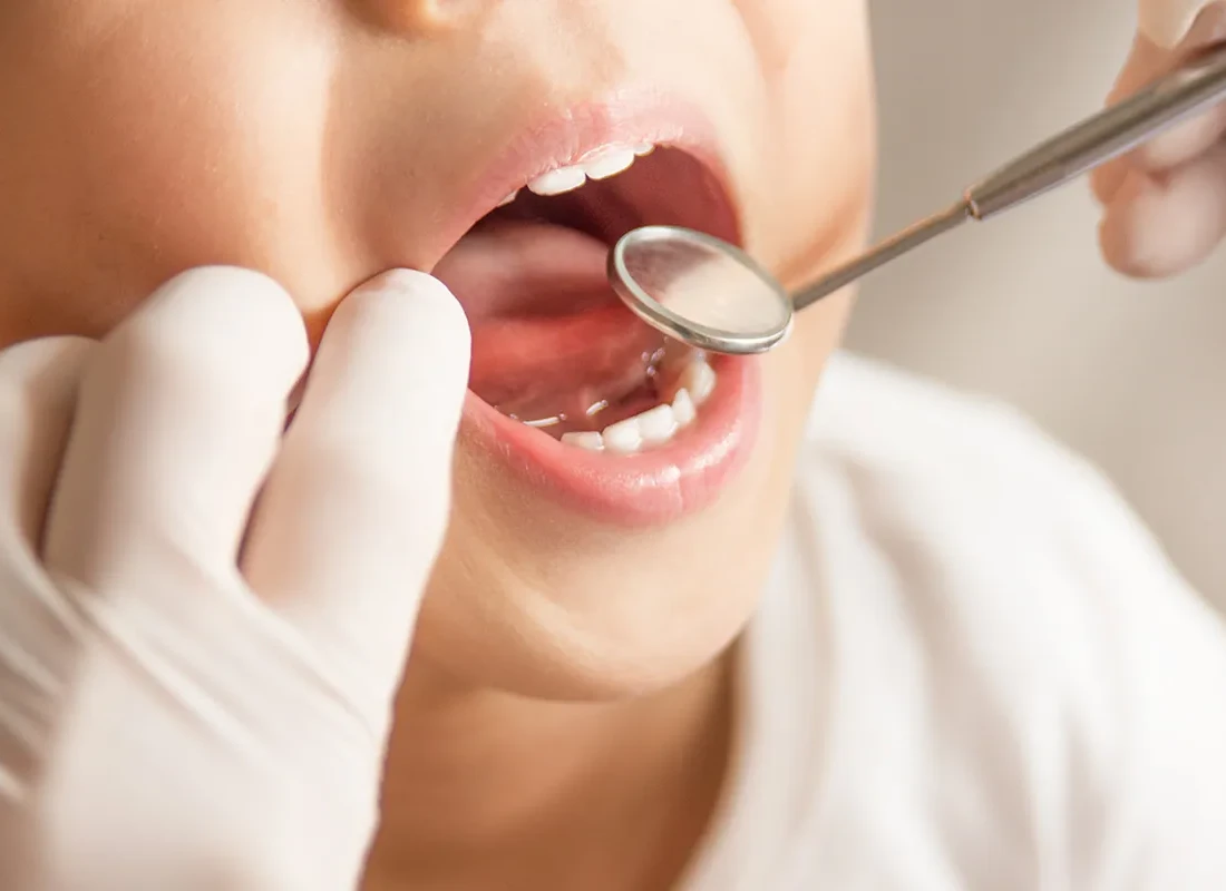 kids-dentist.webp