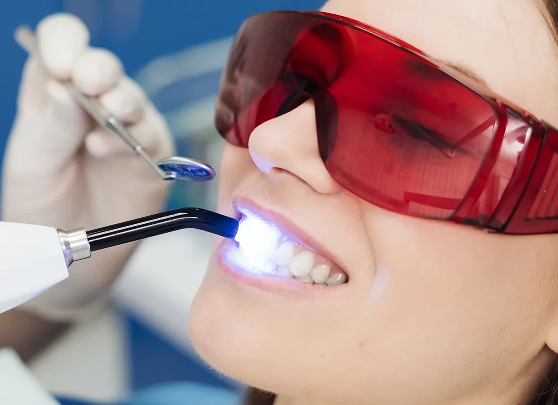 laser-dentistry.webp
