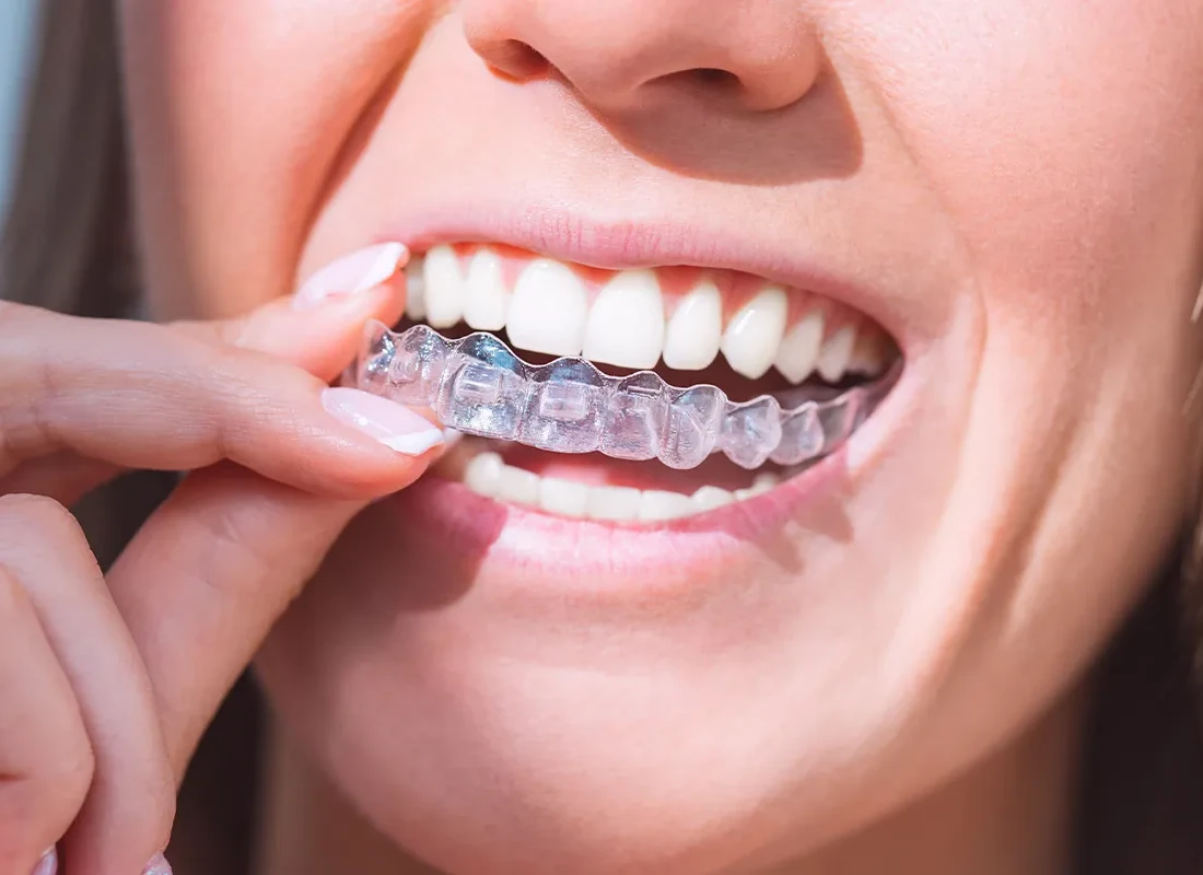 mouth-guard.webp