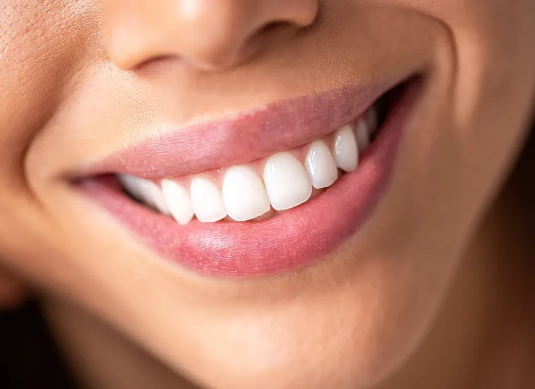 patient-great-smile-4.webp