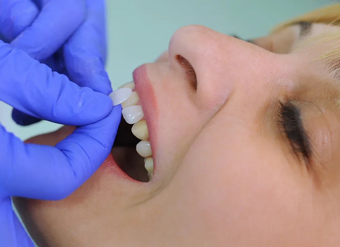 Odontología Cosmética en Exceptional Dentistry